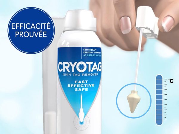 Cryotag Skin Tag Remover