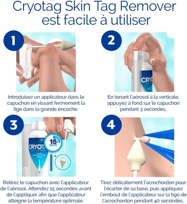 Cryotag Skin Tag Remover