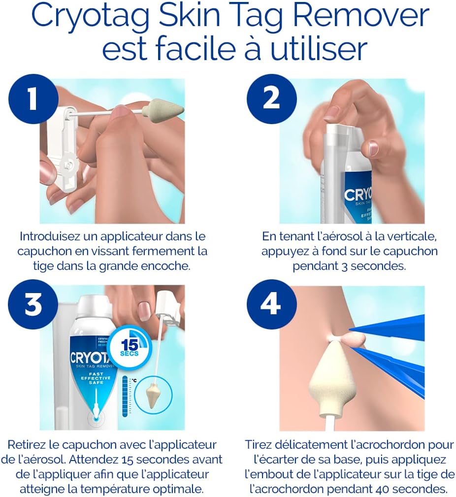 Cryotag Skin Tag Remover